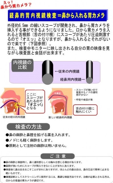 経鼻内視鏡検査について